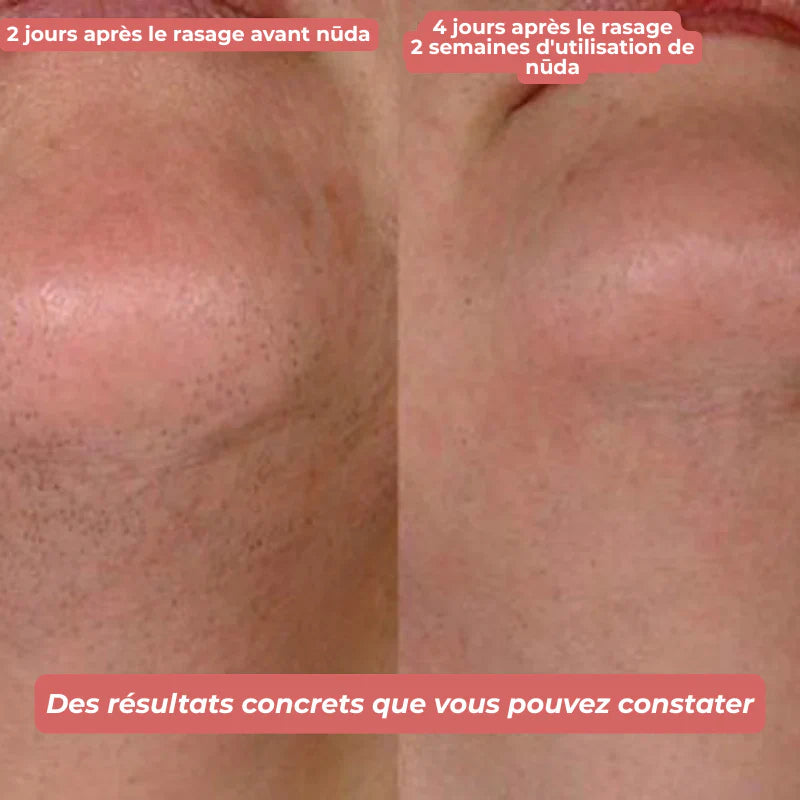 nūda™ Huile de Cyperus Rotundus