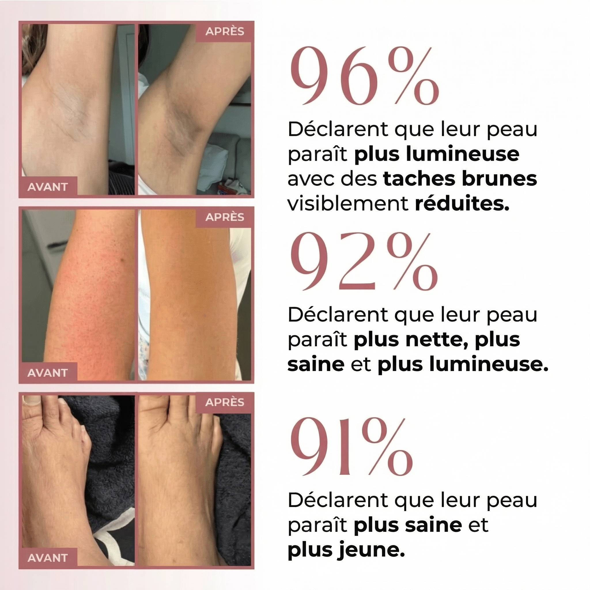 Spray Exfoliant Corps — Acide Kojique + Curcuma