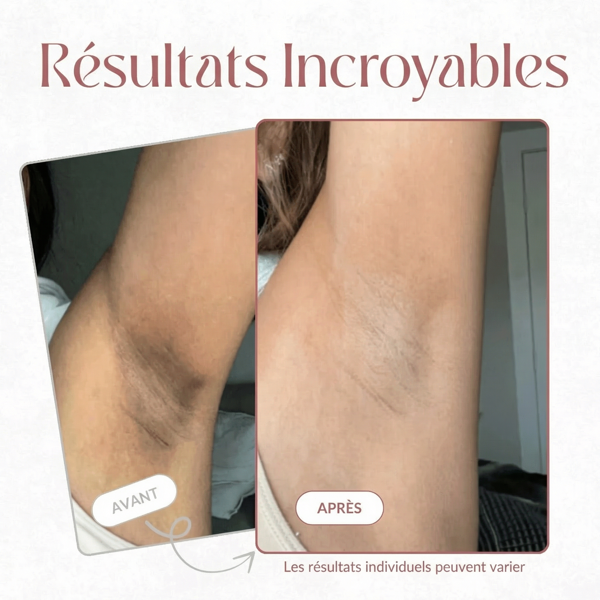 Spray Exfoliant Corps — Acide Kojique + Curcuma